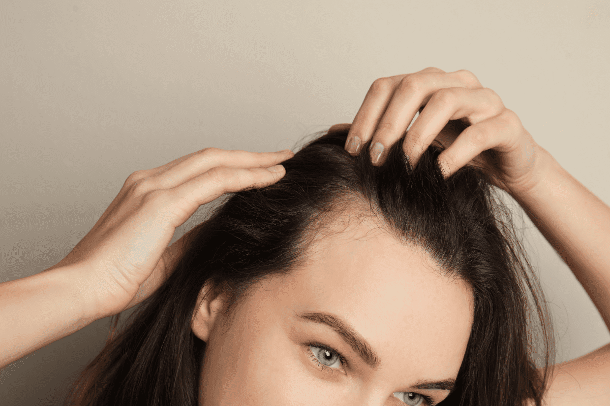 Which Vitamin Deficiency Causes Hair Loss - Healthy Hair Tips 3 Which Vitamin Deficiency Causes Hair Loss, Scalp Health