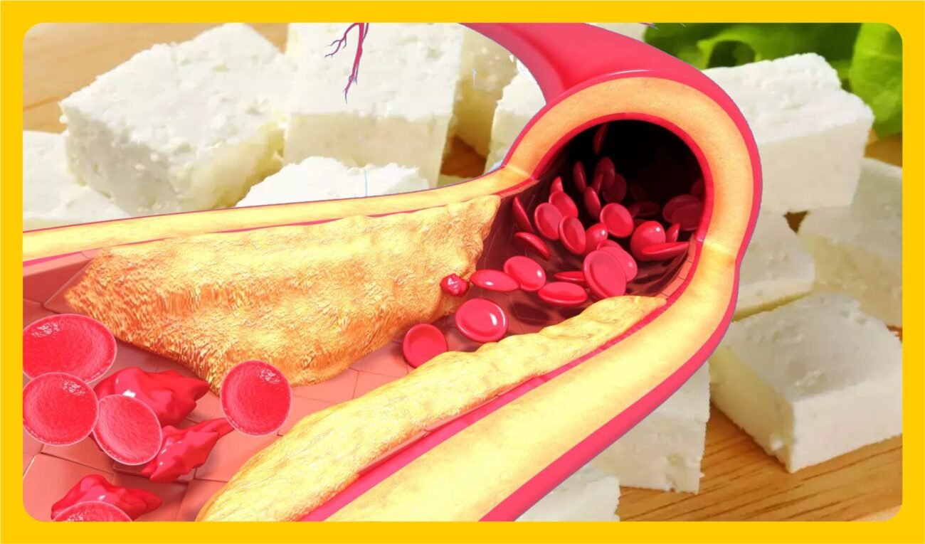 Is paneer good for cholesterol