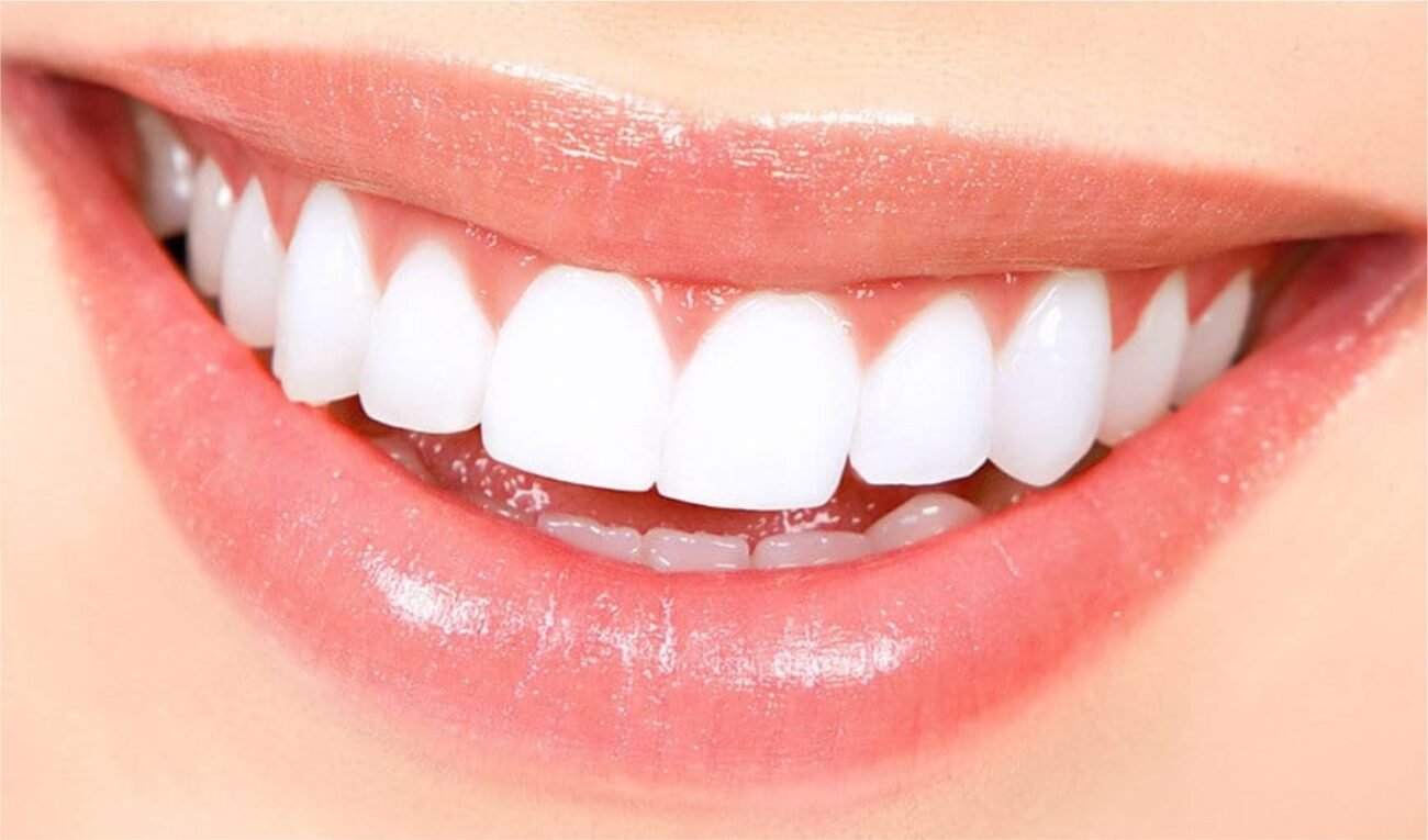 how to whiten teeth instantly