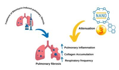 fibrosis in lungs due to covid, lungs fibrosis treatment