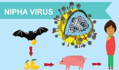 nipah virus kerala,nipah virus symptoms,nipah virus spread