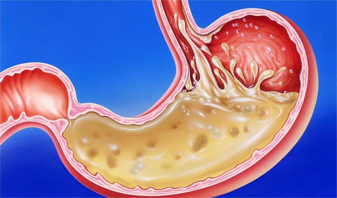 what is the role of acid in our stomach