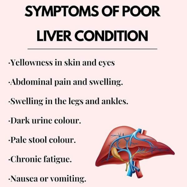 alco detox liver care syrup, symptoms of bad liver