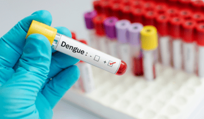 Is dengue a communicable disease, Dengue Treatment