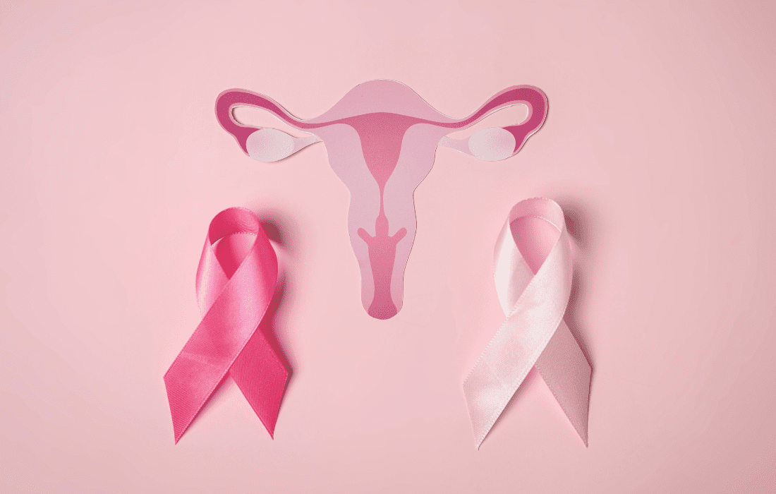 PCOD and PCOS Difference - A Closer Look at PCOD and PCOS Differences 1 PCOD and PCOS Difference, women wellness