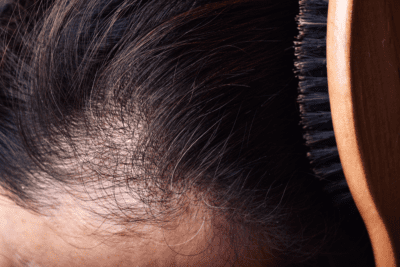 Is Methi Good for Hair, Nourish Scalp 
