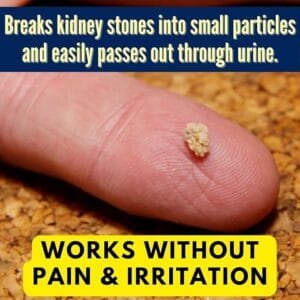 kidney stone remover, ayurvedic syrup for kidney stone